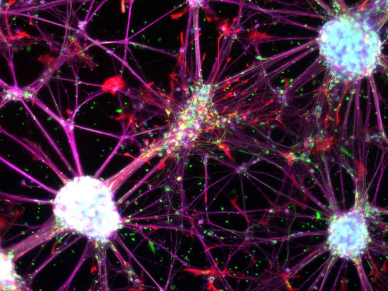 Las células sanguíneas humanas pueden ser reprogramadas directamente en células madre neurales