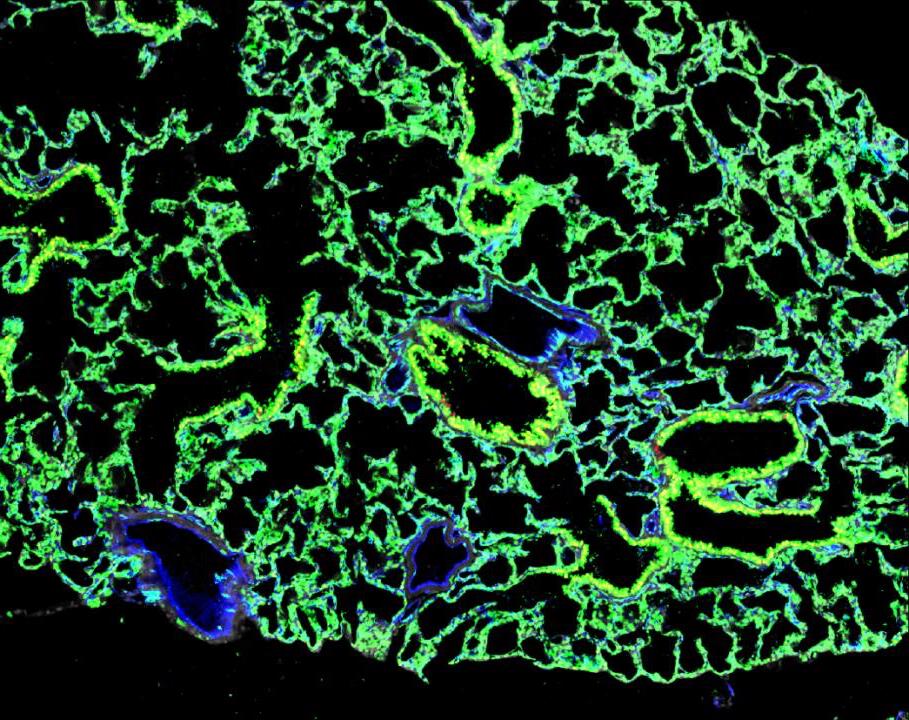 Los trasplantes de células madre se utilizan para desarrollar pulmones completamente funcionales en ratones