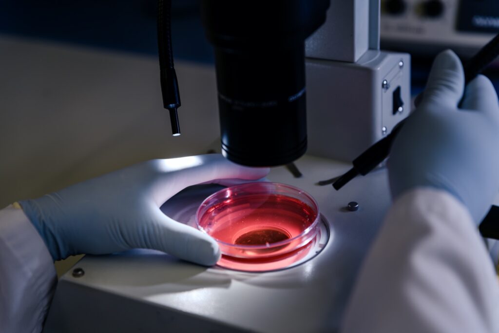 Doctores del sur de la Florida comienzan ensayos de tratamiento con células madre para casos graves de COVID-19